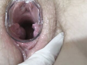 Aged lesbian babes play in a gynecologist, open the pussy with a medical dilator, examine the cervix.