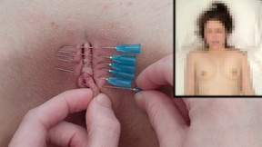 BF Piercing Her Pussy Shut w/ Needles / Painful BDSM Sewing Sewn
