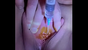 Urethral injection