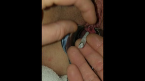 Peehole Cigarette torture. BDSM Speculum Stretched Female Urethral Sounding