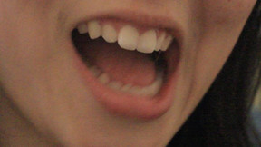 Aurora's Teeth Tease Madly