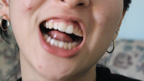 Aurora's Arousing White Teeth
